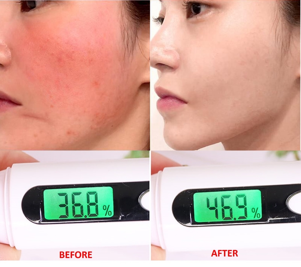 Tinh chất ốc sên đen giảm sẹo lõm - sẹo mụn Some By Mi Snail Truecica Miracle Serum