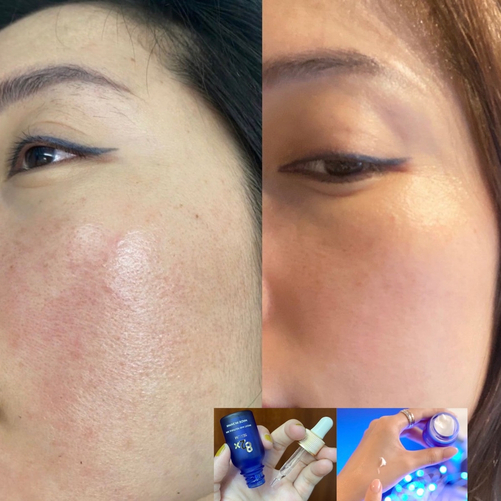 Bộ Dưỡng Da Công Nghệ Tế Bào Gốc 82X AI Stem Cell Serum & Cream Skincare