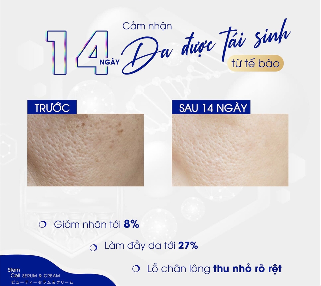 Bộ Dưỡng Da Công Nghệ Tế Bào Gốc 82X AI Stem Cell Serum & Cream Skincare