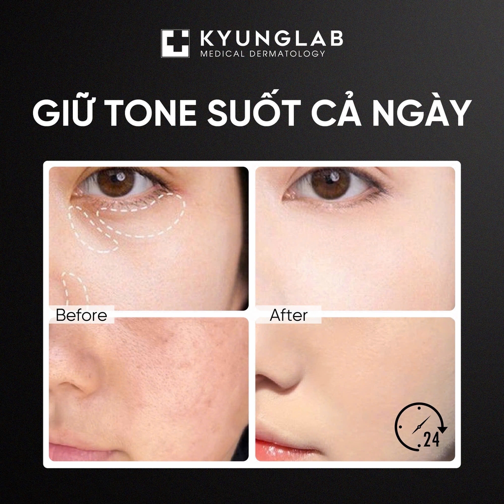 Cushion Kyunglab Mẫu Mới