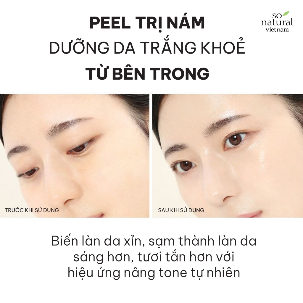 Serum Trắng Da Mờ Nám Redpeel White Tingel Serum So Natural 30ml