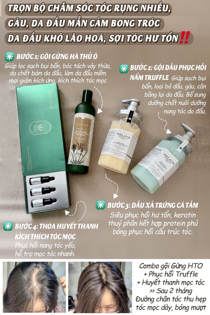 Trọn Bộ Chăm Tóc Tóc Weilaiya Dành Cho Da Đầu Khô, Mẫn Cảm, Rụng nhiều, Da đầu lão hóa - Combo Hoàn Hảo