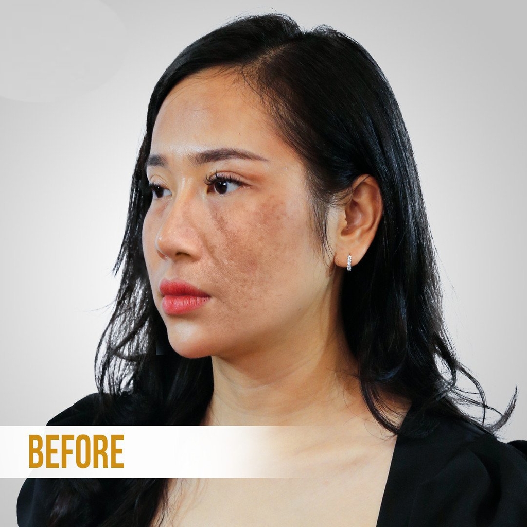Bộ đôi Trị Nám & Dưỡng Sáng Da Dr.K