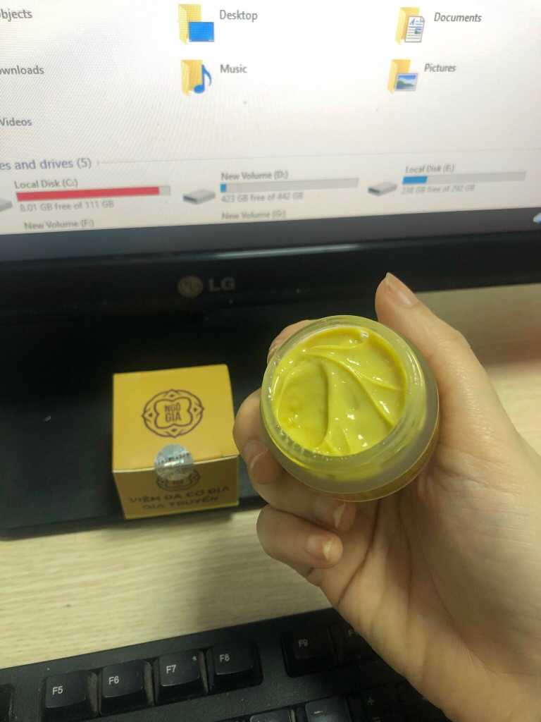 Viêm Gia Cơ Địa Ngô Gia