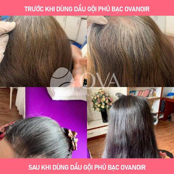 [HN] Dầu gội phủ bạc Ova Noir 200ml