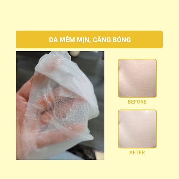 Mặt nạ làm trắng da, mờ thâm nám Mediheal Vita Toning Essence Mask - Miếng 20g