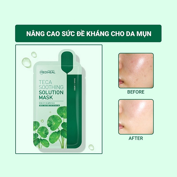 Mặt nạ chuyên sâu cao cấp dành cho da mụn Mediheal Teca Soothing Solution Mask - Miếng 21g
