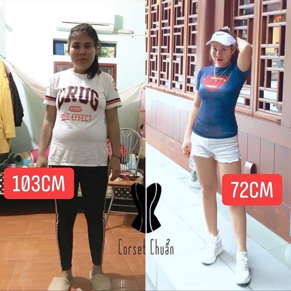 [HCM] Đai nịt bụng Latex Corset Chuẩn Chính Hãng Hy Lạp - Màu đỏ