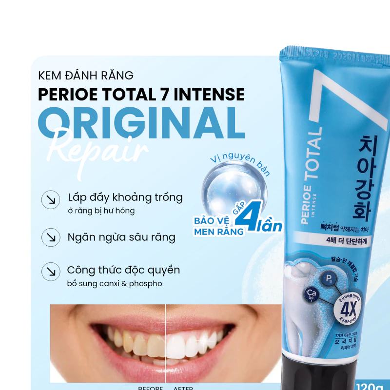 Kem Đánh Răng Perioe Total7 Intense 120g