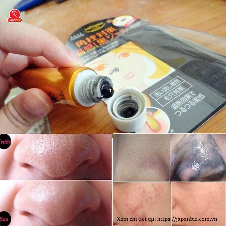 Gel lột mụn Hot Cleansing Gel Kose Nhật Bản
