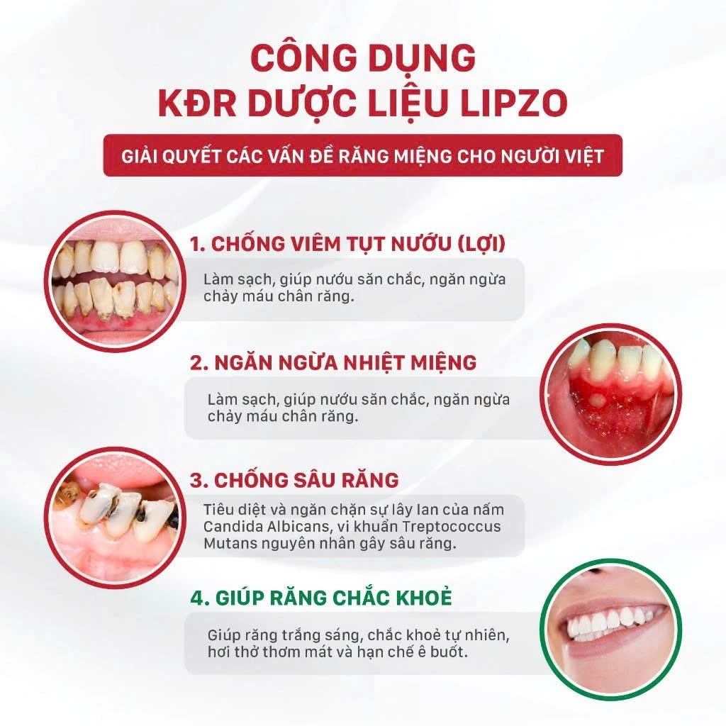 Kem Đánh Răng Lipzo Gum Protect Chống Tụt Nướu 95g Ngăn Ngừa Chảy Máu Chân Răng, Khử Khuẩn, Răng Chắc Khỏe Tự Nhiên