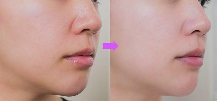 Ủ ĐẤT SÉT 7GF- DỊCH DƯỠNG TÁI TẠO BIỂU BÌ DA