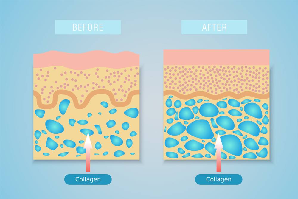 Collagen còn giúp tăng cường độ ẩm và đàn hồi tóc và độ dày móng