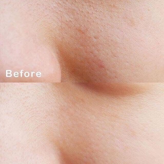 𝐒𝐔̛̃𝐀 𝐑𝐔̛̉𝐀 𝐌𝐀̣̆𝐓 𝐋𝐀𝐁𝐎𝐋𝐀𝐁𝐎-nhật bản
