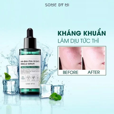 Some By Mi - TINH CHẤT TRỊ Mụn AHA 50ML-hàn