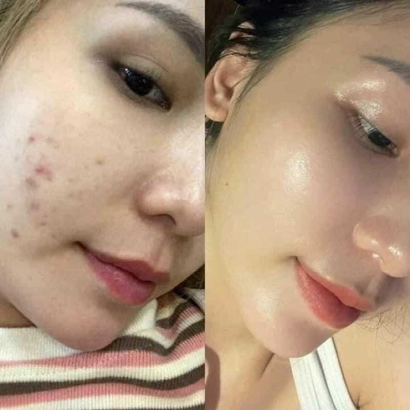 KEM DƯỠNG PREMIUM RETINOL X5-hàn