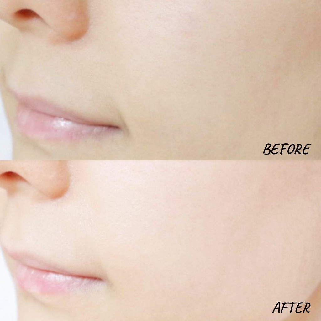 Tinh Chất Dưỡng Da Medi Peel - Bio-Intense GLUTATHIONE (Màu ĐỎ)