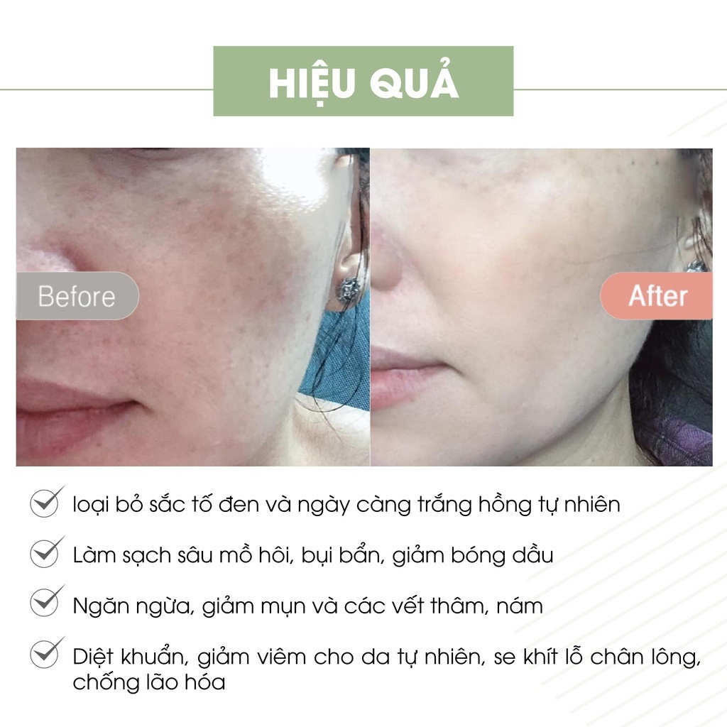Kem Face Pháp A cosmetics dưỡng trắng da mặt 20g, kem whitening face cream