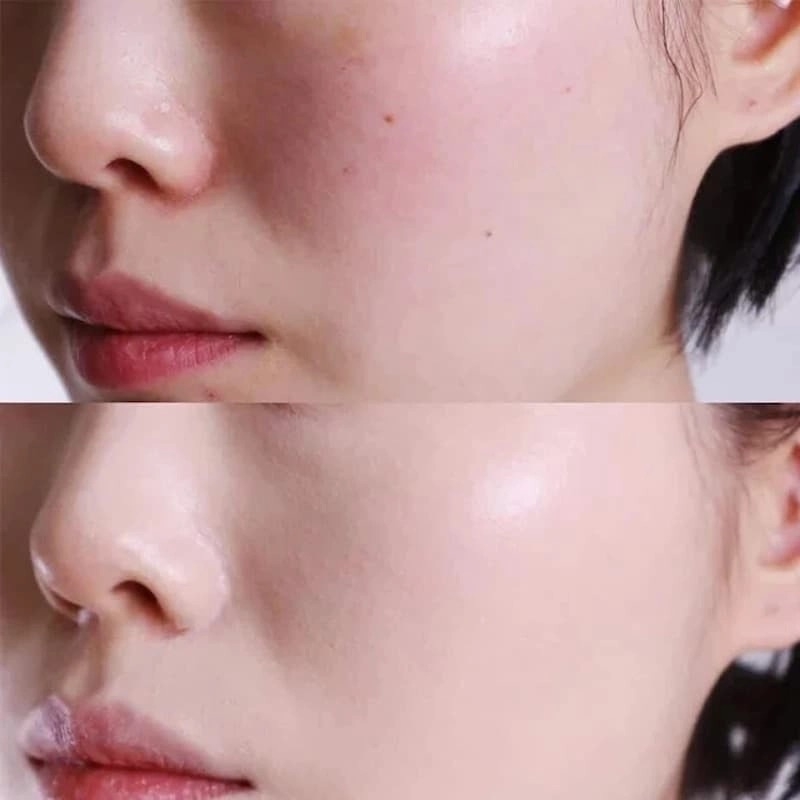 Kem chống nắng SJMmedical-HÀN