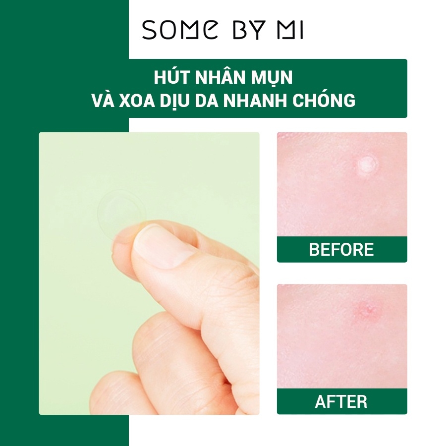 Some By Mi - Miếng Dán Trị Mụn Clear Spot Patch 18pcs-hàn