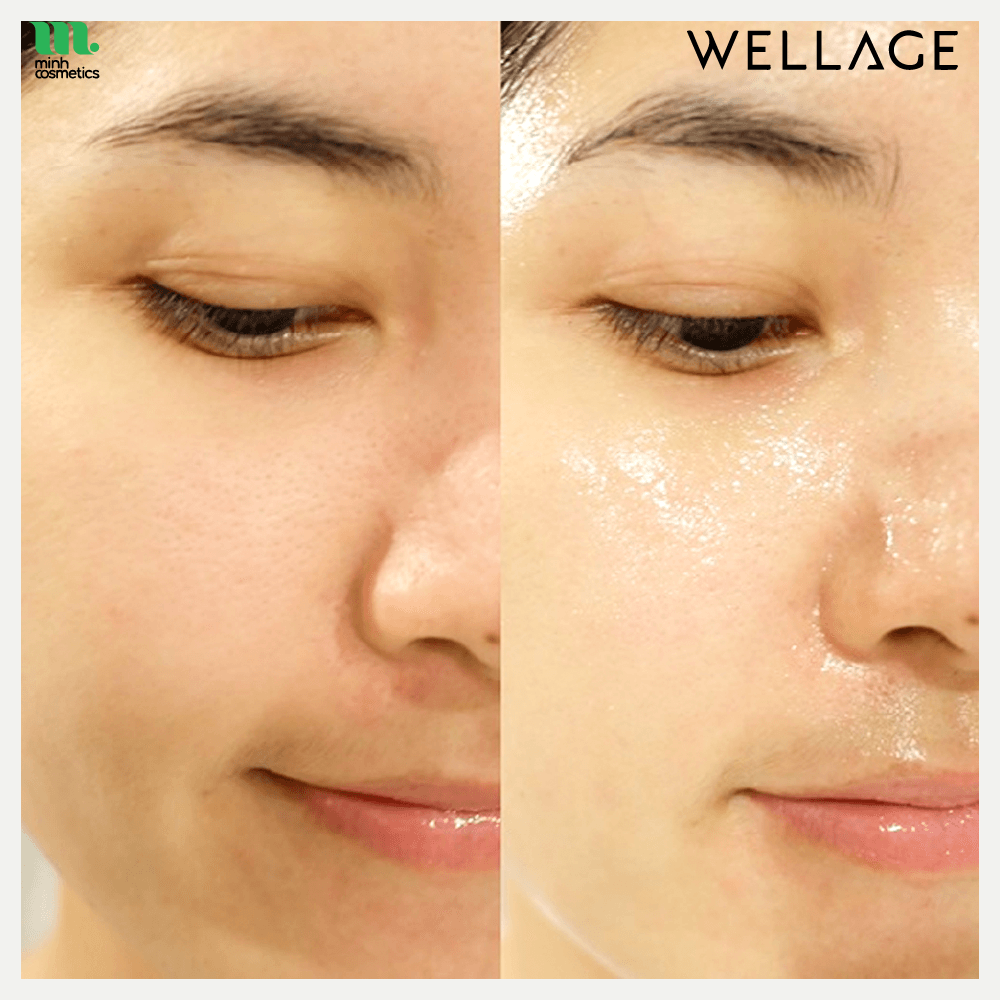 Tinh chất cấp nước WELLAGE Real Hyaluronic Blue Ampoule