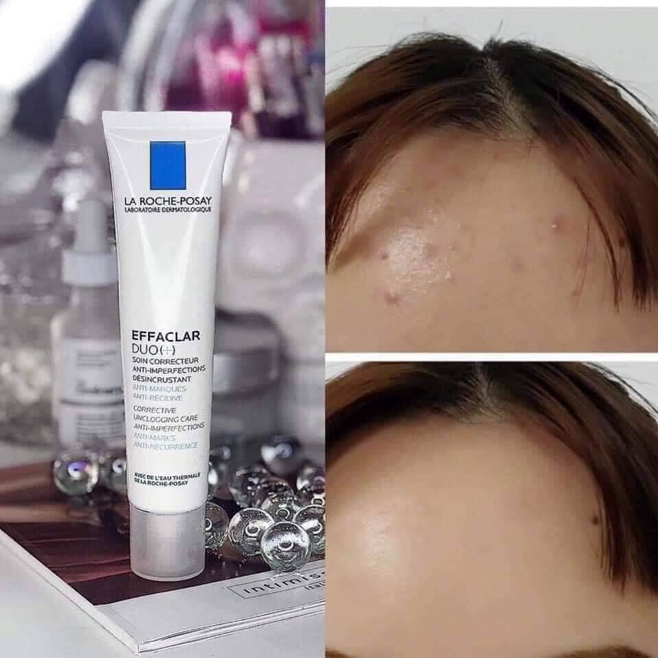 Set trị mụn La Roche Duo + 40ml tặng kèm SRM 50ml-pháp