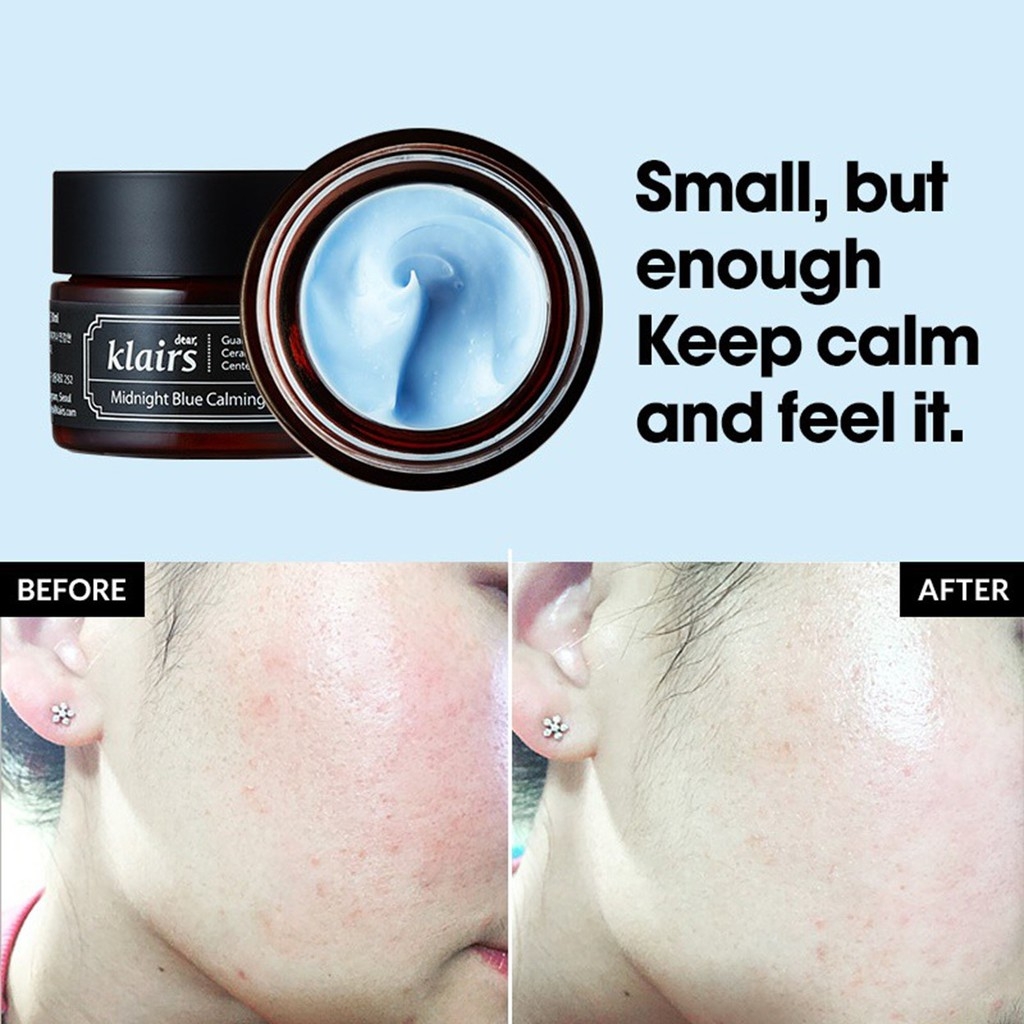 Kem dưỡng - Shiseido Aqualabel 5 trong 1 -nhật