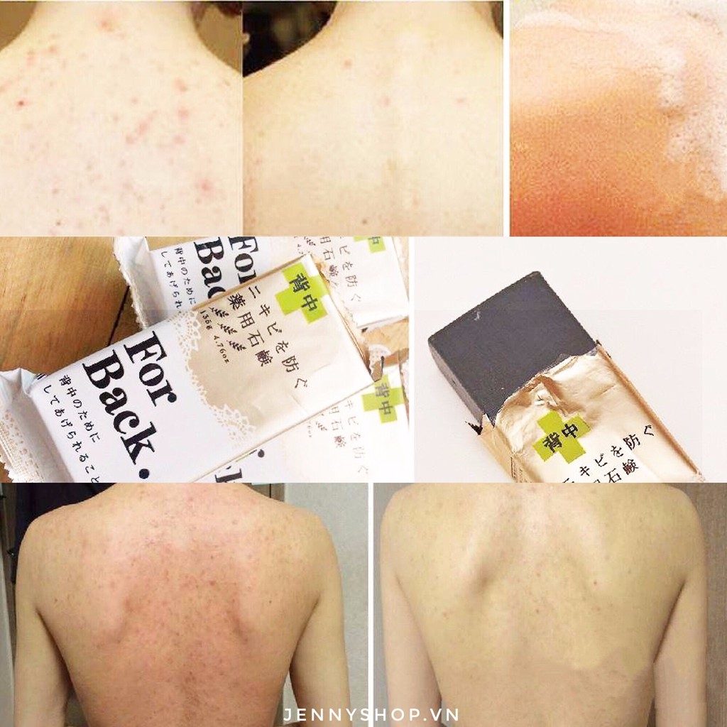 Xà Phòng trị mụn lưng For Back -Nh-nhật