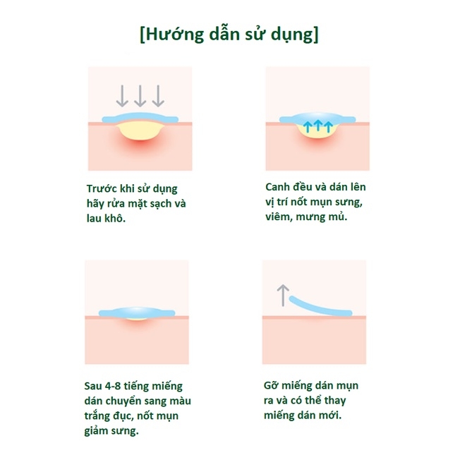 Some By Mi - Miếng Dán Trị Mụn Clear Spot Patch 18pcs-hàn