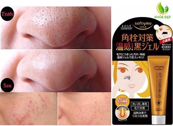GEL LỘT MỤN KOSE _Gel 25g Nhật Bản