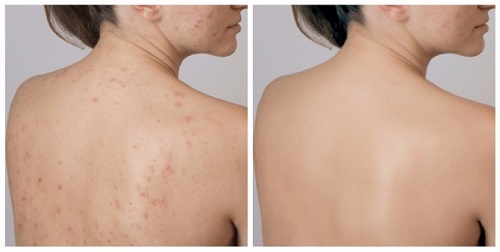 Kem dưỡng - Aloins Eaude Cream S-nhật