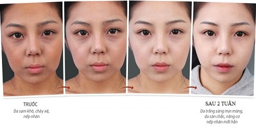 Kem trắng da 7 Day Whitening Program Glutathione 700 V-ample 50ml-hàn