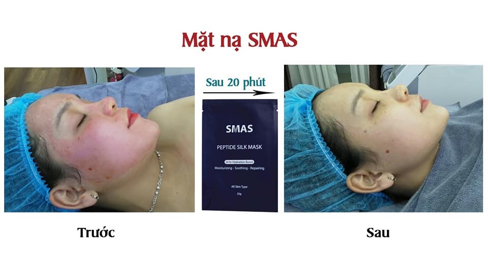 Mặt Nạ Phục Hồi Cấp Ẩm Cao Cấp Smas Peptide Silk Mask- 04miếng-nhật