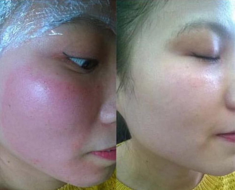 Mặt Nạ Phục Hồi Cấp Ẩm Cao Cấp Smas Peptide Silk Mask- 04miếng-nhật
