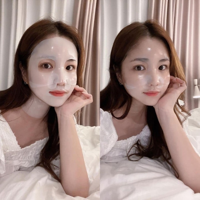 Mặt Nạ Derm all Matrix Facial Dermalcare Mask ( MẪU MỚI màu -4 miếng xanh than)-hàn