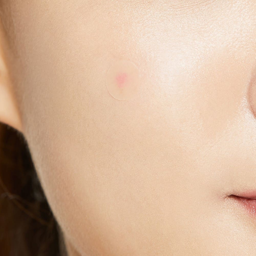Miếng dán mụn cosrx-hàn