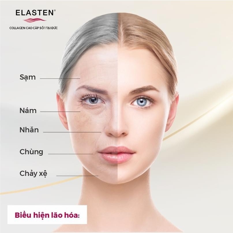 Collagen uống Elasten 28 ống-đức