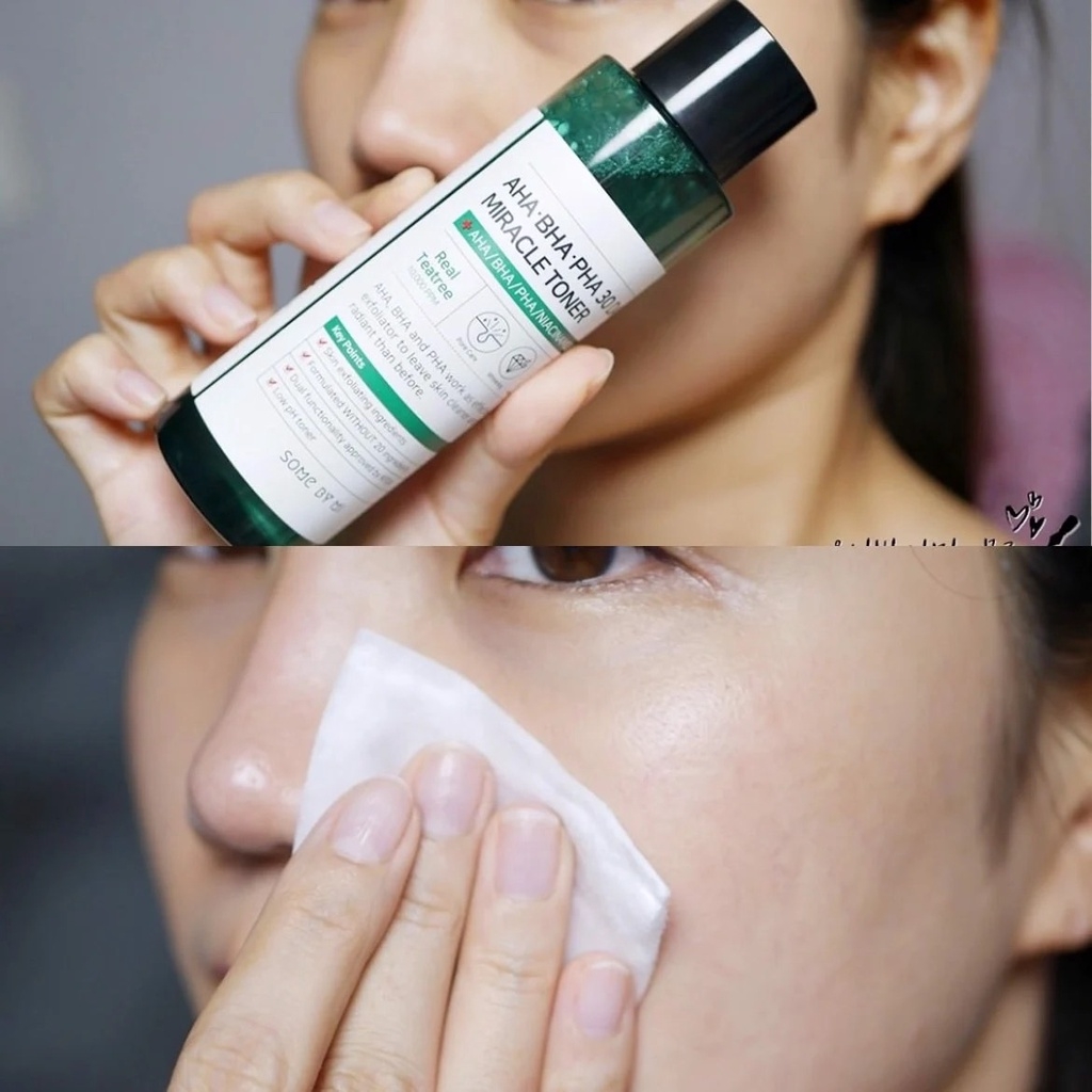 Some By Mi - Nước Hoa Hồng Mụn AHA 150ML