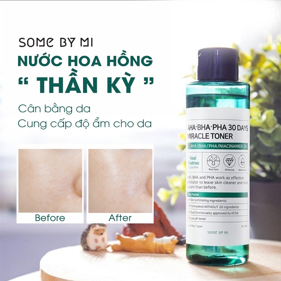 Some By Mi - Nước Hoa Hồng Mụn AHA 150ML