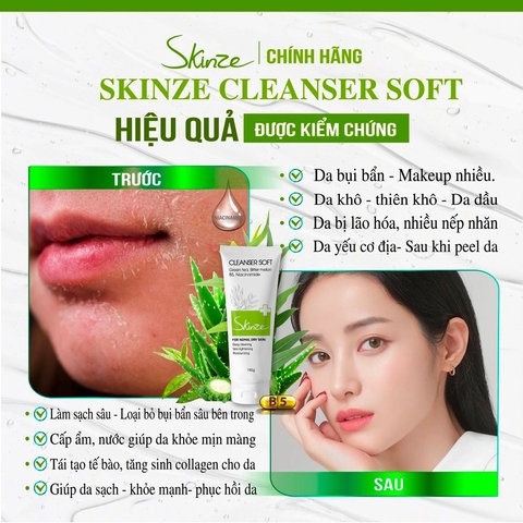 SỮA RỬA MẶT SKINZE CLEANSER SOFT CHO DA KHÔ THƯỜNG NHẠY CẢM TRÀ XANH TRÀM TRÀ KHỔ QUA B5 LÔ HỘI