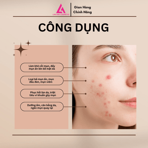 COMBO HẾT MỤN SÁNG DA - SERUM TRỊ MỤN, SỮA RỬA MẶT, KEM CHỐNG NẮNG - TOPMAN LAN ANH