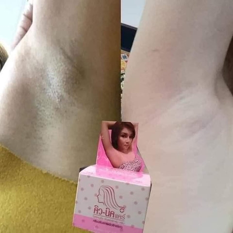 KEM KHỬ THÂM NÁCH MÔNG QNIC CARE THÁI LAN CHÍNH HÃNG 15G-KT1