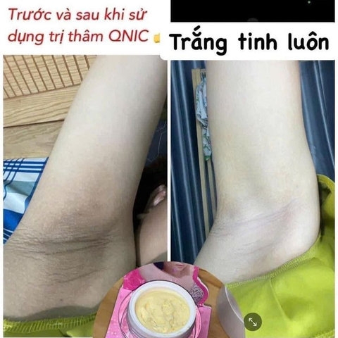 KEM KHỬ THÂM NÁCH MÔNG QNIC CARE THÁI LAN CHÍNH HÃNG 15G-KT1