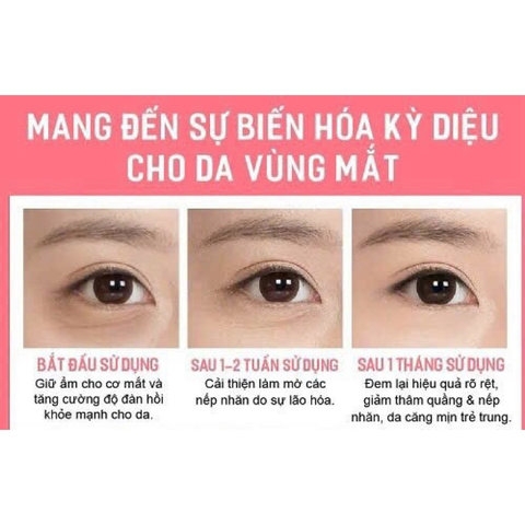 KEM GIẢM THÂM MẮT BỌNG MẮT COLLAGEN PLUS VIT E 701 CHÍNH HÃNG - GDN