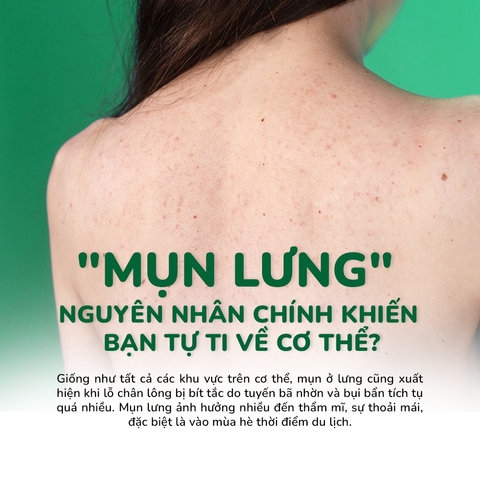 SỮA TẮM TRÀM TRÀ GIẢM MỤN LƯNG VÀ BODY NEOACNES 250ML - NEO ACNES