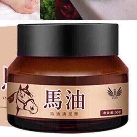 KEM DẦU NGỰA TRỊ NẺ, KHÔ DA, NỨT GÓT CHÂN