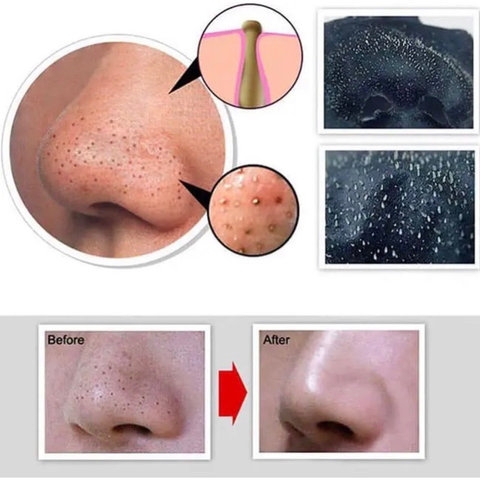 GEL LỘT MỤN THAN TRE PHÁP COSMETIC 30GR - GDN