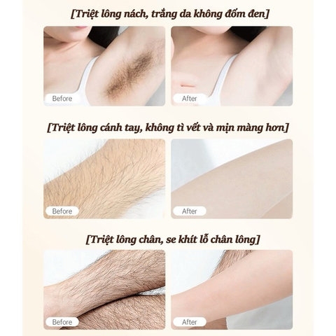 KEM TẨY LÔNG SADOER NỘI ĐỊA TRUNG 150ML - GDN