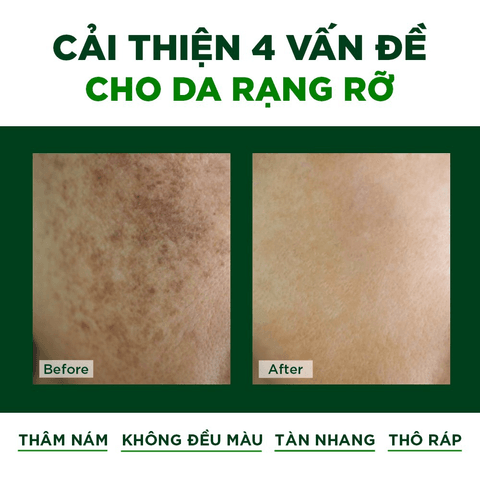 VIÊN SERUM GIÚP DƯỠNG DA, LÀM MỜ VẾT THÂM NÁM ORIBE 36 VIÊN