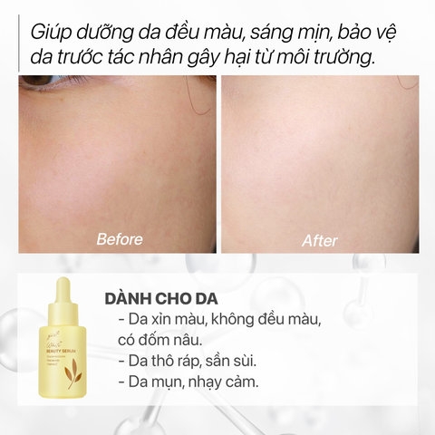 SERUM DƯỠNG TRẮNG MỜ THÂM NÁM, CĂNG BÓNG NGỪA MỤN - GUO